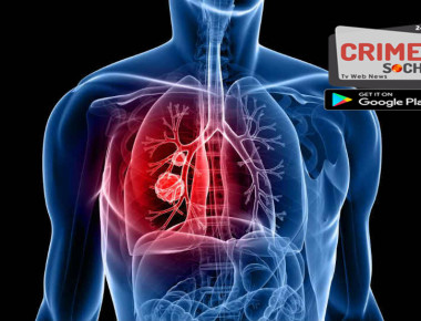 lung-canadwadwawddawadscer-1